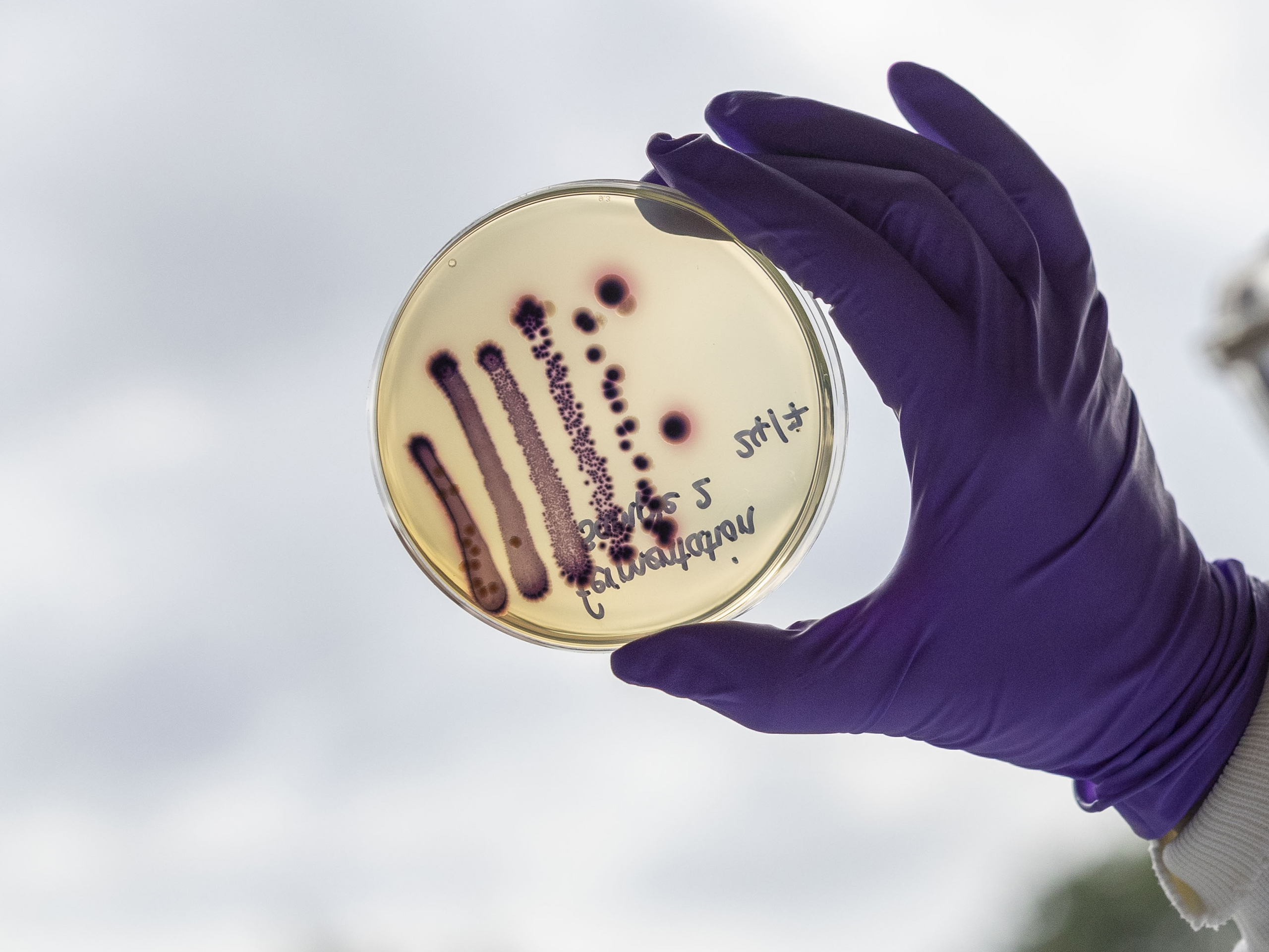 Accurate Diagnostics, Smarter Prescribing: The Twin Engines of Antimicrobial Stewardship
